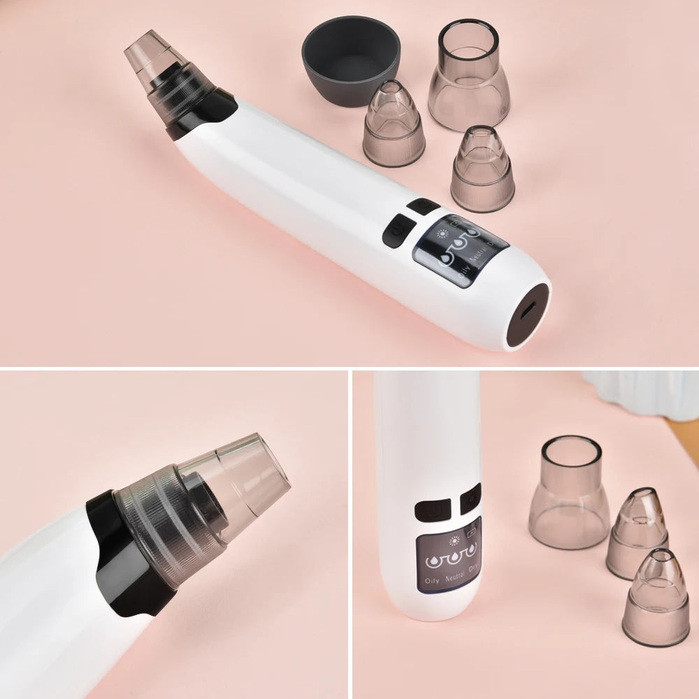 Blackhead Remover Vacuum Acne Pimple Black Spot Suction Electric Facial Pore Cleaner Skincare Exfoliating Beauty Instrument