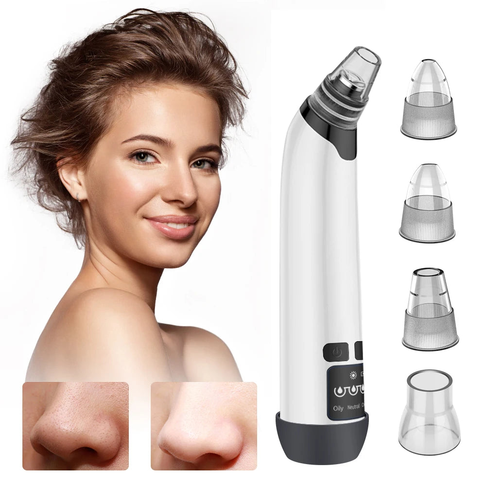 Blackhead Remover Vacuum Acne Pimple Black Spot Suction Electric Facial Pore Cleaner Skincare Exfoliating Beauty Instrument