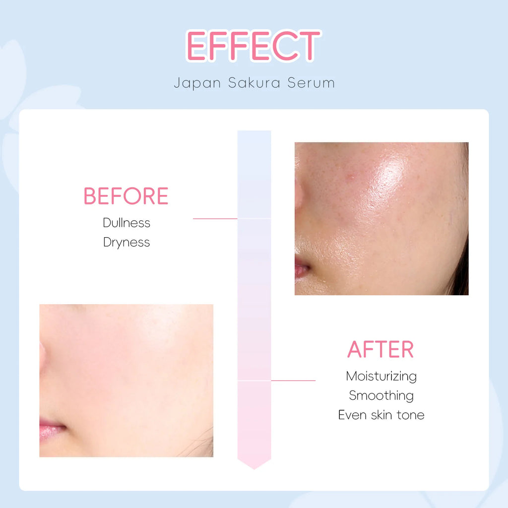Sakura Whitening Face Serum Fade Fine Lines Anti Aging Tighten Pores Improve Melanin Pigment Dull Moisturizer Brighten Skin Care