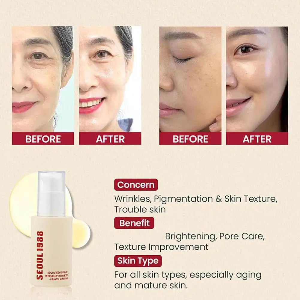 Seoul 1988 Retinol Face Care Serum With Black Ginseng Niacinamide Vitamin C Long-lasting Moisturizing Firming Ampoule Skin Care